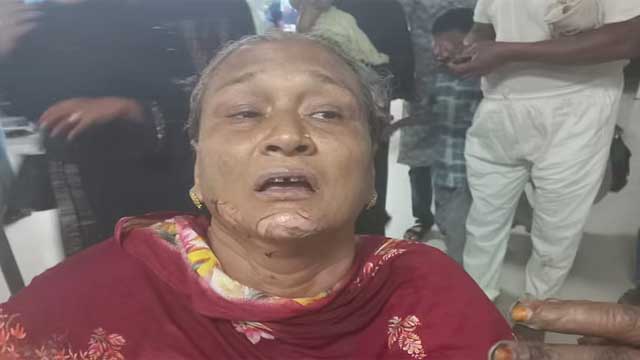 চট্টগ্রামে অটোরিকশায় মুখোশধারীদের পেট্রলবোমা, দগ্ধ ২